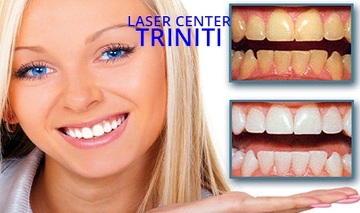 -75% popust na lasersko beljenje zob po izbiri za popol - Kuponko.si
