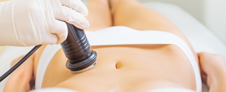 Do 82% popust na pakete oblikovanja telesa s kavitacijo - Kuponko.si