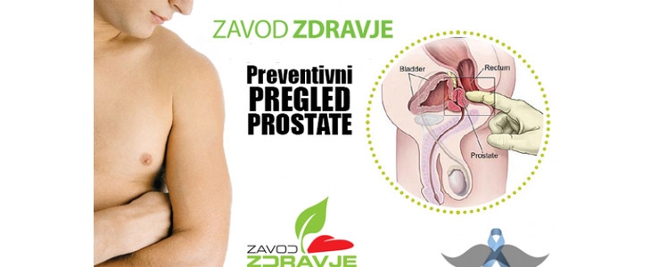 HUDA CENA na neinvaziven preventivni pregled prostate n - Kuponko.si