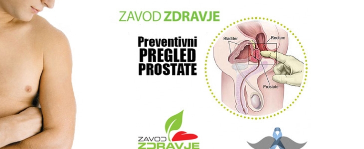 HUDA CENA na preventivni diagnostični pregled PROSTATE - Kuponko.si