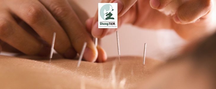 Do 77% popust na hujšanje z akupunkturo po tradicionaln - Kuponko.si