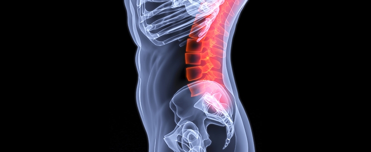 HUDA CENA za preventivni ultrazvočni pregled osteoporoz - Kuponko.si