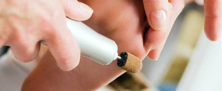 Do HUDA CENA na medicinsko pedikuro ali Freezpen odstra - Kuponko.si