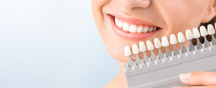 Neverjetno učinkovito pisalo za beljenje zob Hello Smil - Kuponko.si