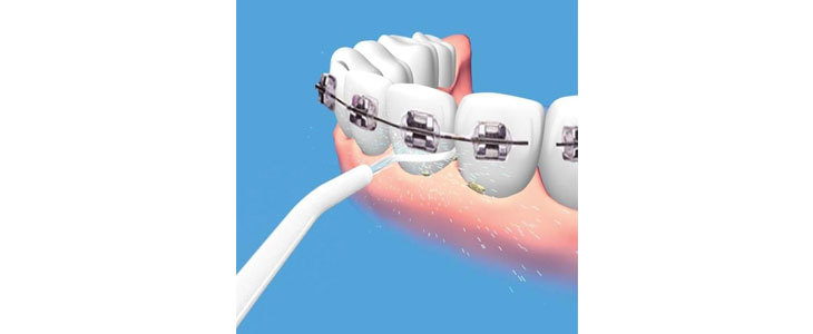 Brezžicna zobna prha Power Floss za ciščenje zob in ust - Kuponko.si
