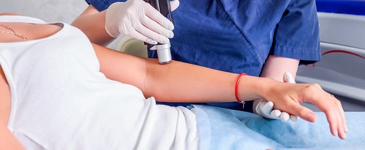 Laserski tretma odstranjevanja pigmentacij - Kuponko.si