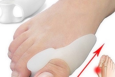 Par ščitnikov Hallux Valgus za nožne palce Par ščitnikov Hallux Valgus za nožne palce