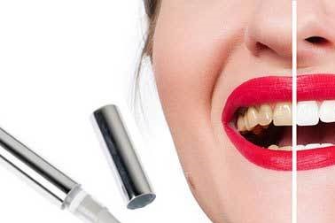 Pisalo za beljenje zob Hello Smile Pisalo za beljenje zob Hello Smile