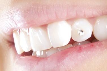 Modni zobni kristalček primeren za moške in ženske