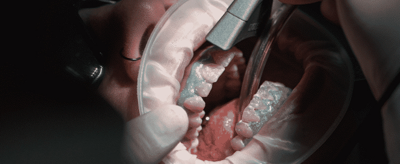 OrthoDental ordinacija: lasersko beljenje zob - Kuponko.si