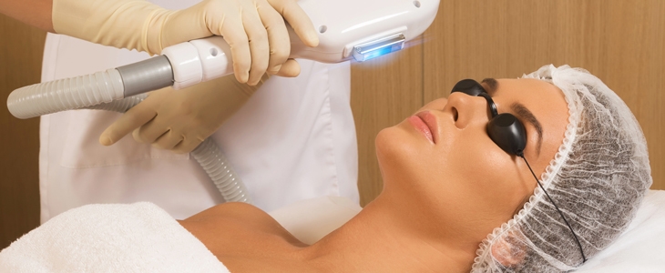 Salon Phyts Kranj: lasersko odstranjevanje aken - Kuponko.si