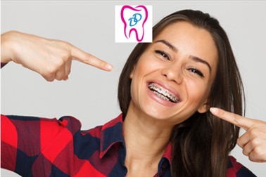 Dami Dent: konvencionalni zobni aparat