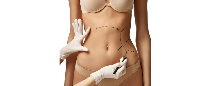 Center Bodylife: aromawickel terapija, limfna drenaža - Kuponko.si