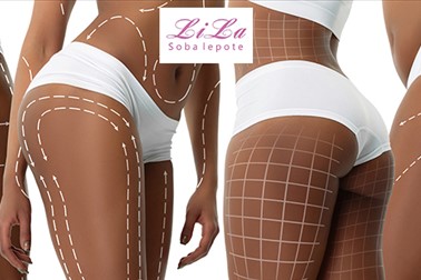 Soba lepote LiLa: tretma za oblikovanje telesa Soba lepote LiLa: tretma za oblikovanje telesa