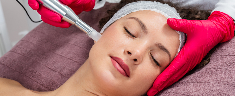 Beauty World by Tanja: microneedling, pomlajevanje - Kuponko.si