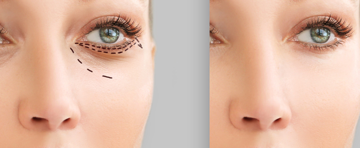 Project Beauty salon, korekcija vek - Kuponko.si
