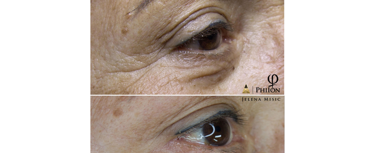 Project Beauty salon, korekcija vek - Kuponko.si