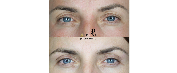 Project Beauty salon, korekcija vek - Kuponko.si