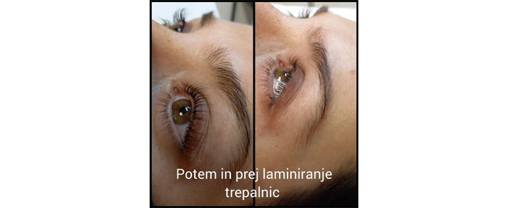 Lepotni studio Shine: laminiranje trepalnic z botoksom - Kuponko.si