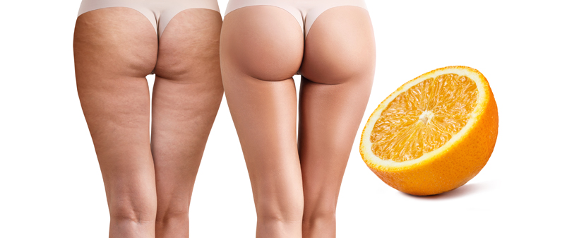 Spa & Beauty Tea: body shape, presoterapija - Kuponko.si