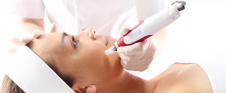 Društvo Vitus: vakuumski microneedling - Kuponko.si