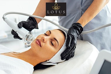 Lotus, točka kozmetike in estetike, microneedling Lotus, točka kozmetike in estetike, microneedling