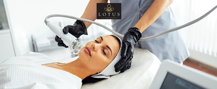 Lotus, točka kozmetike in estetike, microneedling - Kuponko.si