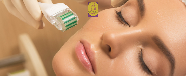 Salon Vital&Lepa, microneedling obraza - Kuponko.si