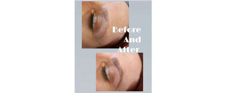 Kozmetične storitve Vanja Žnidar, lash filler - Kuponko.si