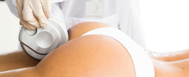 Sense Wellness: endospheres terapija - Kuponko.si