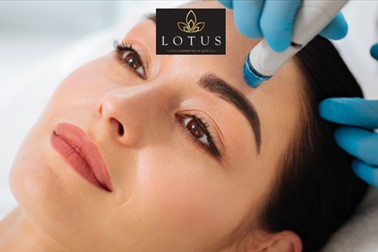 Lotus, točka kozmetike in estetike, Hydrafacial tretma