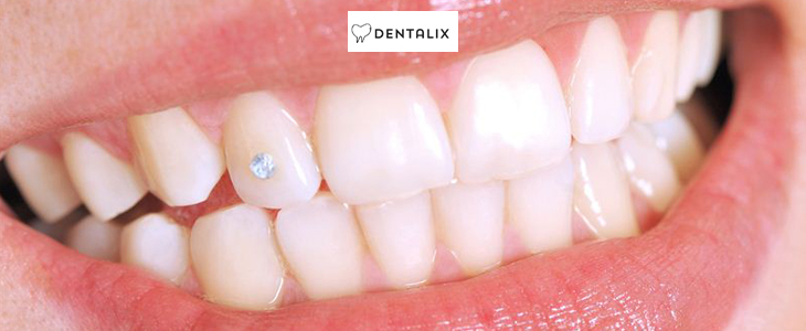 Dentalix; čiščenje zobnega kamna - Kuponko.si