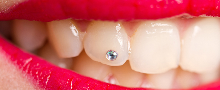 Dentalix; čiščenje zobnega kamna - Kuponko.si