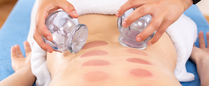 Masažni salon Nirvana: cupping terapija - Kuponko.si
