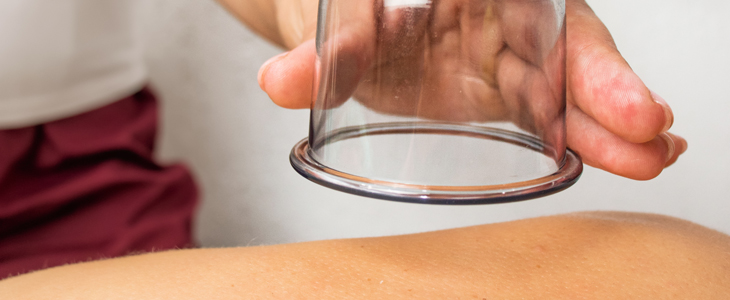 Masažni salon Nirvana: cupping terapija - Kuponko.si