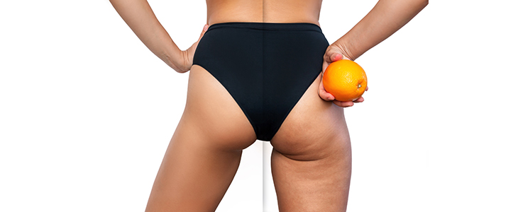 Terme Ptuj, wellness Valens Augusta: lipo detox - Kuponko.si
