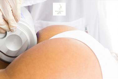 Sense Wellness: endospheres terapija