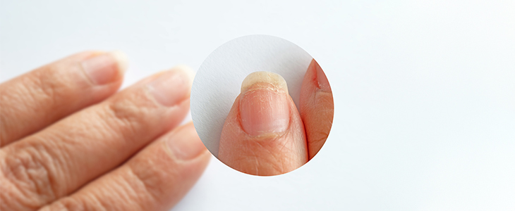 Lepotni studio Shine: IBX nega nohtov - Kuponko.si Lepotni studio Shine: IBX nega nohtov - Kuponko.si