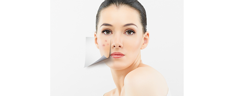 Mesto Lepote: globinska nega obraza - Kuponko.si Mesto Lepote: globinska nega obraza - Kuponko.si