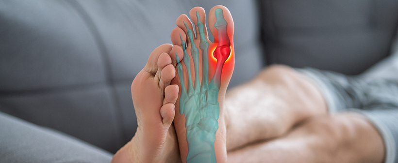 Komplet silikonskih opornic za nego ukrivljenih prstov! - Kuponko.si Komplet silikonskih opornic za nego ukrivljenih prstov! - Kuponko.si