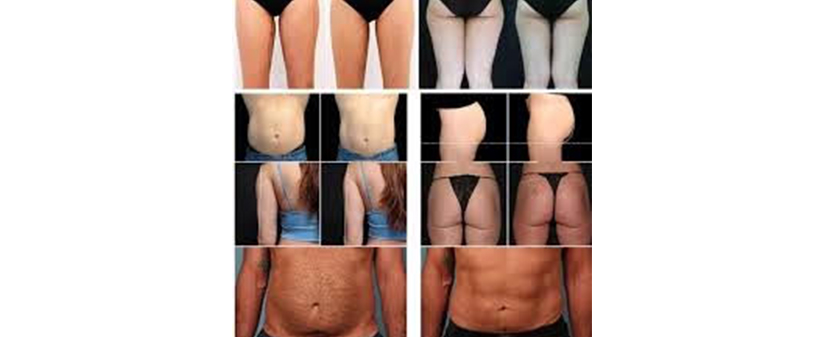 Lepotni studio Mi día: oblikovanje telesa z Ems Tesla - Kuponko.si Lepotni studio Mi día: oblikovanje telesa z Ems Tesla - Kuponko.si