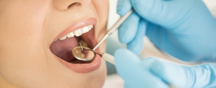 Čiščenje zobnega kamna, peskanje in poliranje  - Kuponko.si