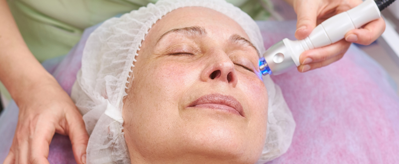 Studio AuraVital, radiofrekvenca obraza - Kuponko.si