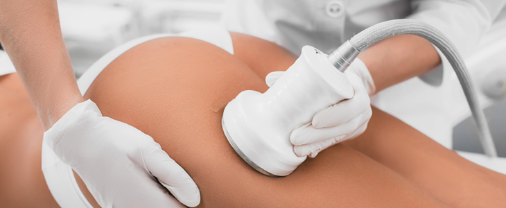 Studio AuraVital, preoblikovanje telesa - Kuponko.si