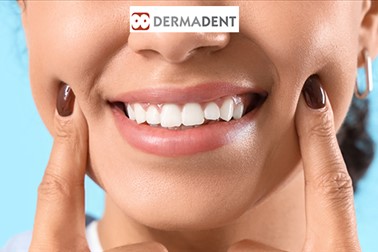 Dermatologija Dermadent: odstranitev zobnega kamna