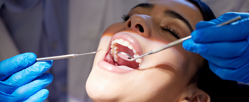 Dermatologija Dermadent: odstranitev zobnega kamna - Kuponko.si