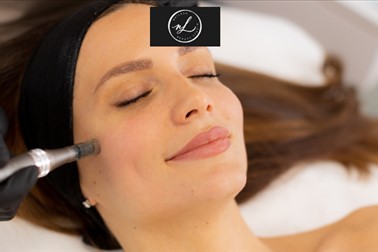 Nailash beauty studio, Microneedling obraza (1 obisk)