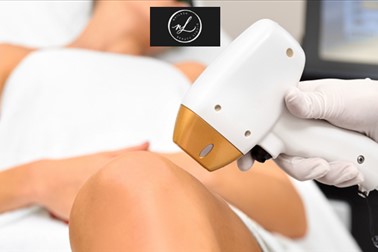 Nailash beauty studio, Lasersko odstranjevanje dlačic