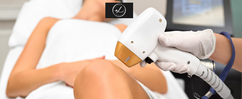 Nailash beauty studio, Lasersko odstranjevanje dlačic - Kuponko.si