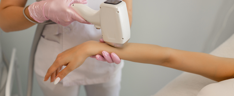 Nailash beauty studio, Lasersko odstranjevanje dlačic - Kuponko.si